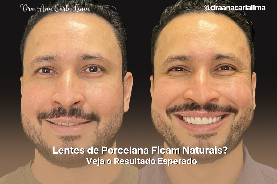 Lentes de Contato